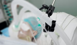 Image of a mechanical ventilator
