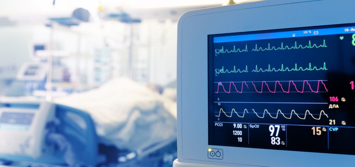 Image of a heart monitor in an ICU room