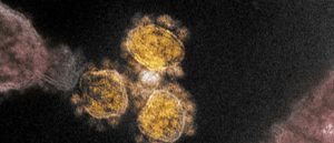 Electron microscope image of the SARS-CoV-2 virus