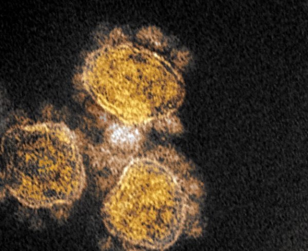 Electron microscope image of the SARS-CoV-2 virus