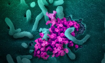 sars-cov-2-electron-microscope