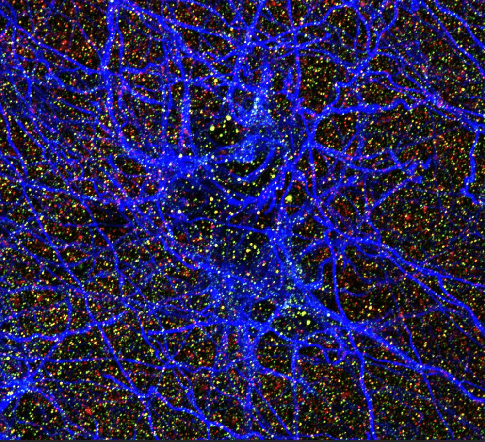 25_The Universe inside your brain_Klein