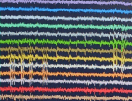 Neuralpixel recordings of brain activity.