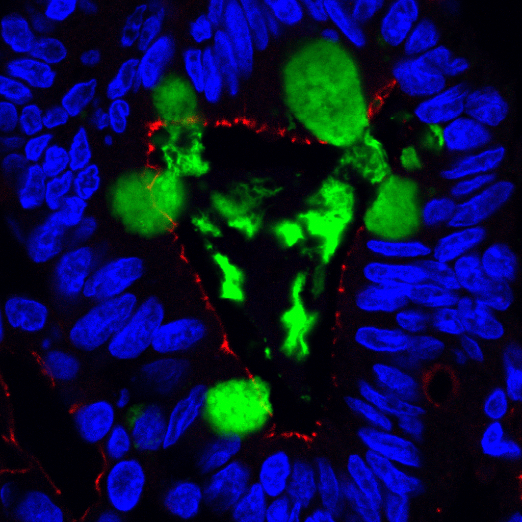 Malnourished organoids cultured in the 75% media formulation. The samples were stained for nuclei (blue), tight junction protein (red), and mucus (green). What you see is mucus being secreted from goblet cells into the center of the organoid, which would be the lumen of the intestine where food passes through. 